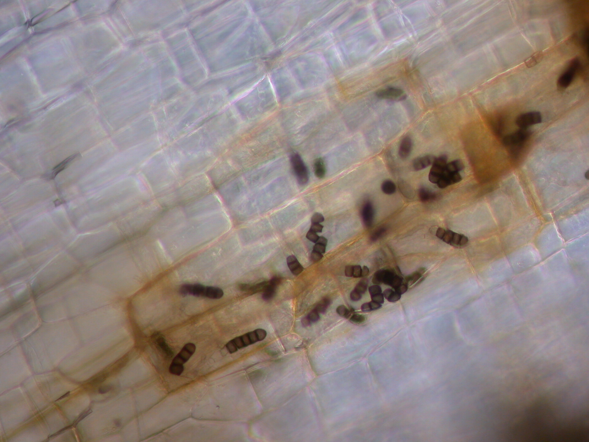 Figure 4. The structures seen here in root tissue are specialized spores known as chlamydospores.