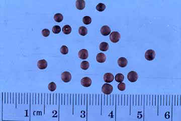 Hairy Vetch Seeds