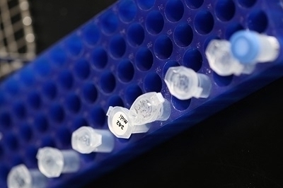 Image of lab beakers on blue case