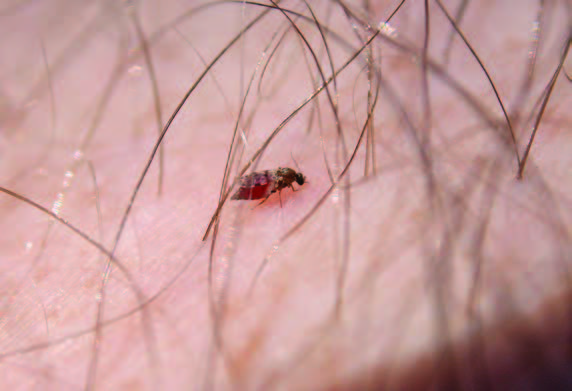 A biting fly engorges on human blood.