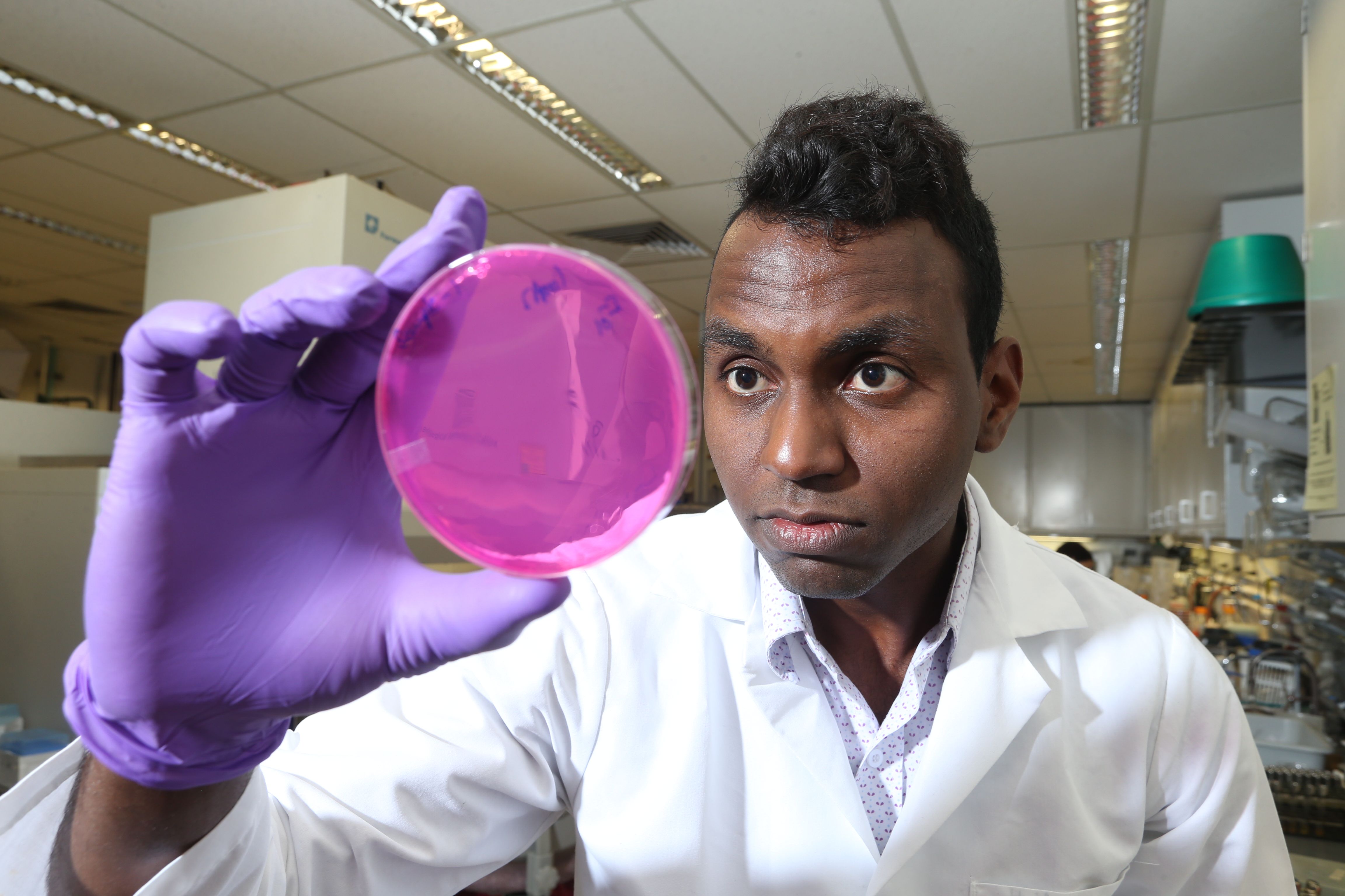 scientist holding agar plate