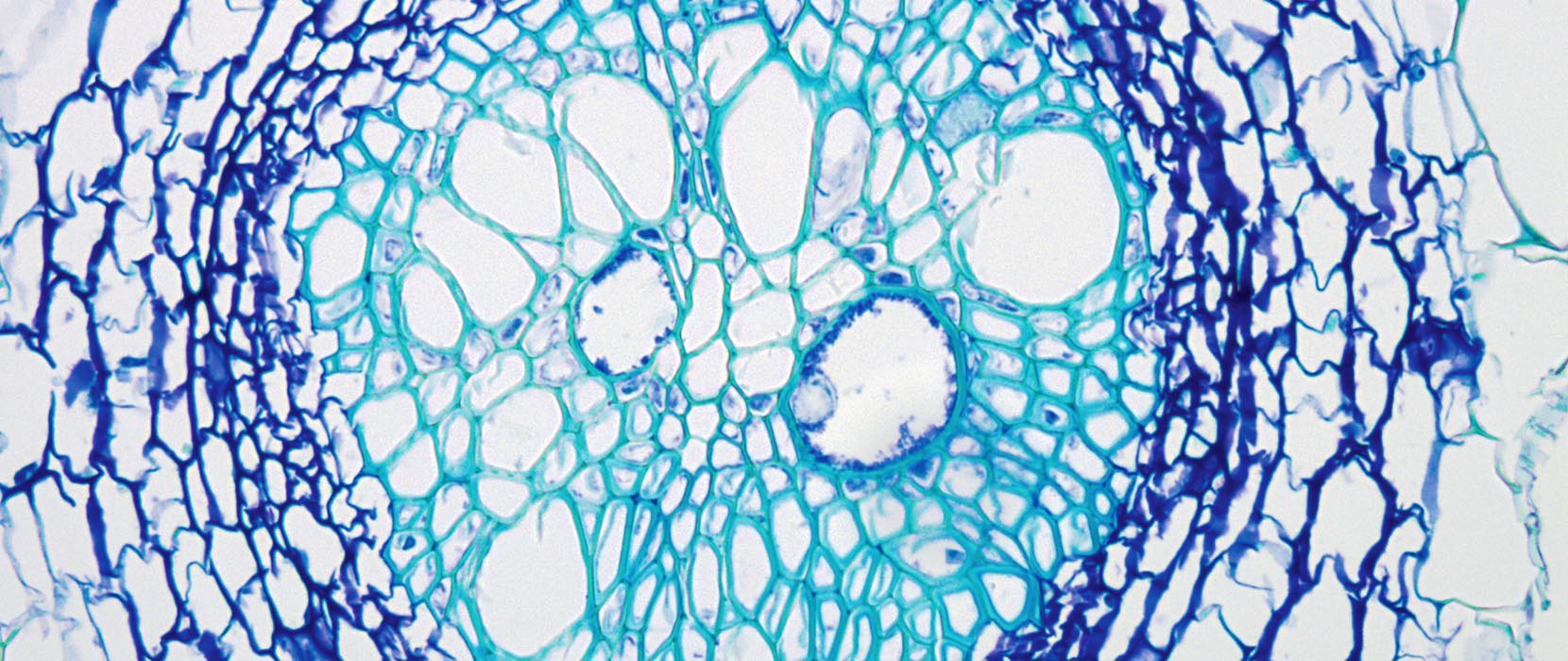 plant root cell
