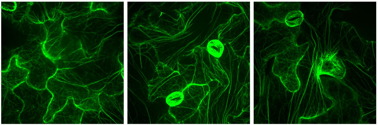 Microscopic images of cell skeleton in uninfected and infected plant cells