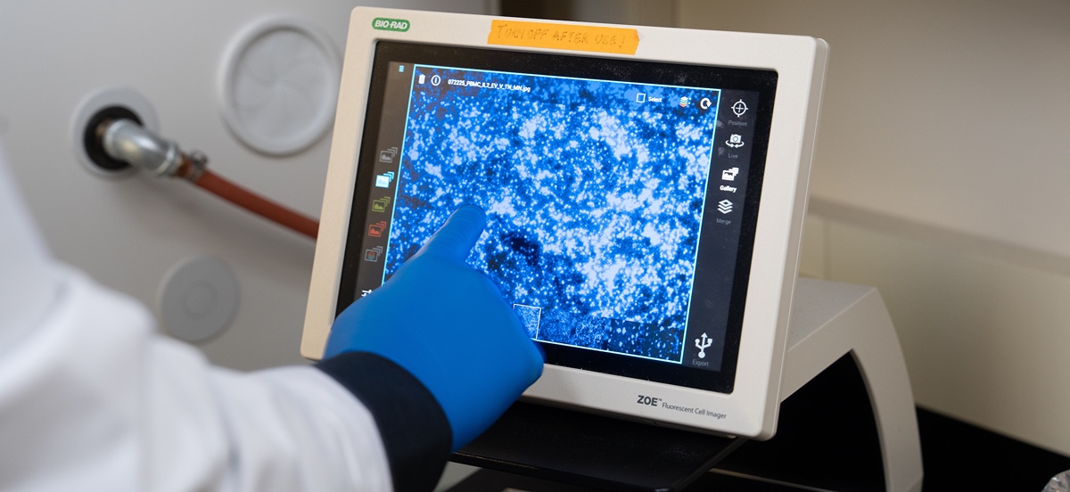 A person in a lab coat analyzing magnified cells.