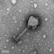 Phage Ebner lab specimen