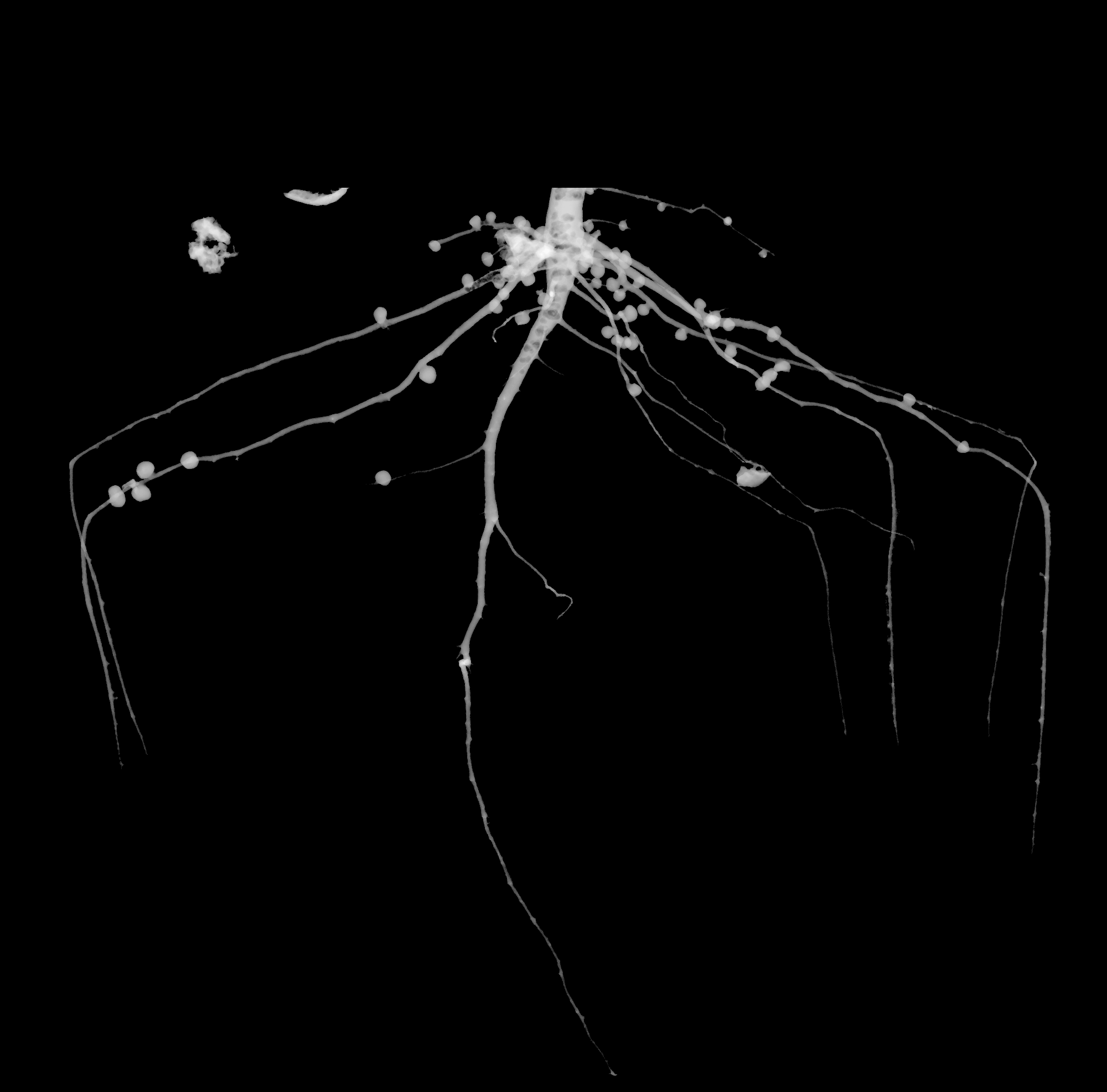 X-Ray of soybean root